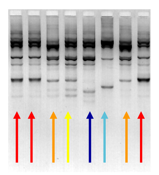 DNA fingerprinting techniques can identify which bacterial strains are the same, and different. The four different colours show the four different strains of Streptococcus uberis present 